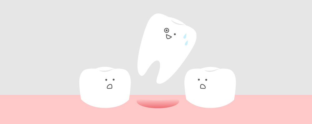 にしき歯科医院の歯が抜ける原因の解説