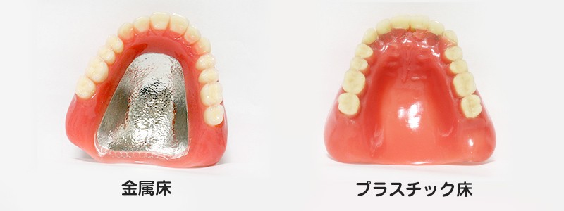 入れ歯の画像(金属床・プラスチック床)
